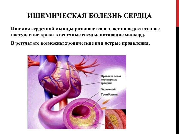 ИШЕМИЧЕСКАЯ БОЛЕЗНЬ СЕРДЦА Ишемия сердечной мышцы развивается в ответ на