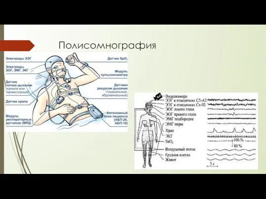 Полисомнография