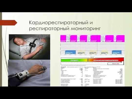 Кардиореспираторный и респираторный мониторинг