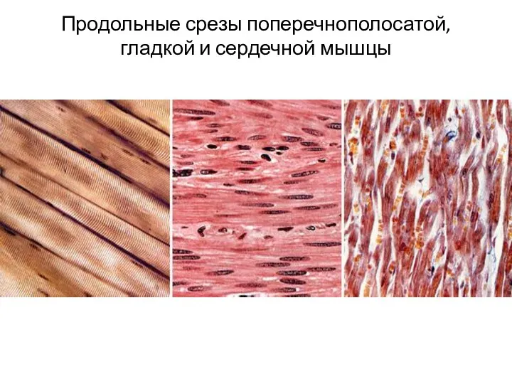 Продольные срезы поперечнополосатой, гладкой и сердечной мышцы