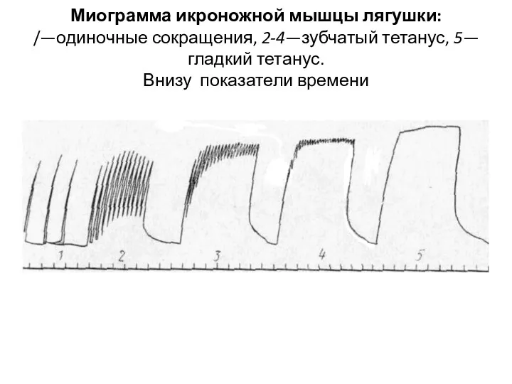 Миограмма икроножной мышцы лягушки: /—одиночные сокращения, 2-4—зубчатый тетанус, 5— гладкий тетанус. Внизу показатели времени