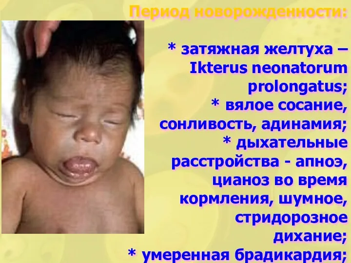 Период новорожденности: * затяжная желтуха – Ikterus neonatorum prolongatus; *