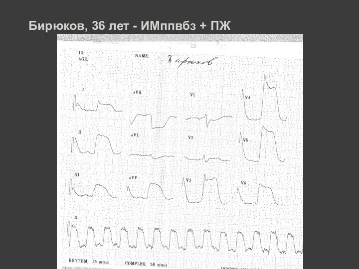 Бирюков, 36 лет - ИМппвбз + ПЖ