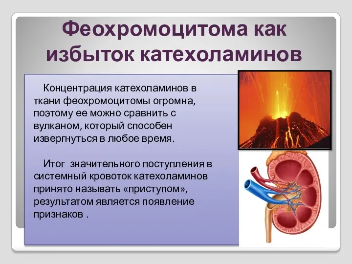 Феохромоцитома как избыток катехоламинов Концентрация катехоламинов в ткани феохромоцитомы огромна,