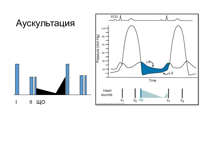 Аускультация I II ЩО