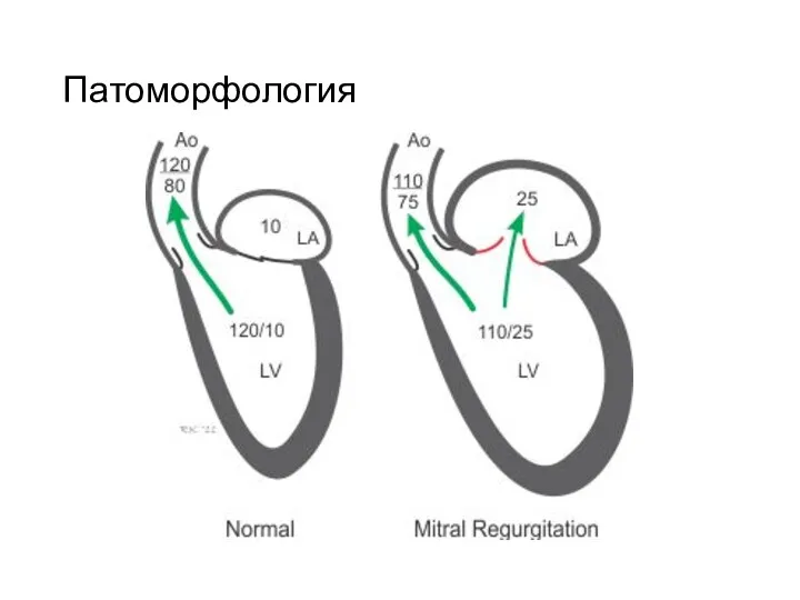 Патоморфология