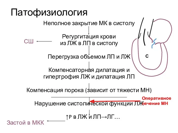 Патофизиология Неполное закрытие МК в систолу Регургитация крови из ЛЖ