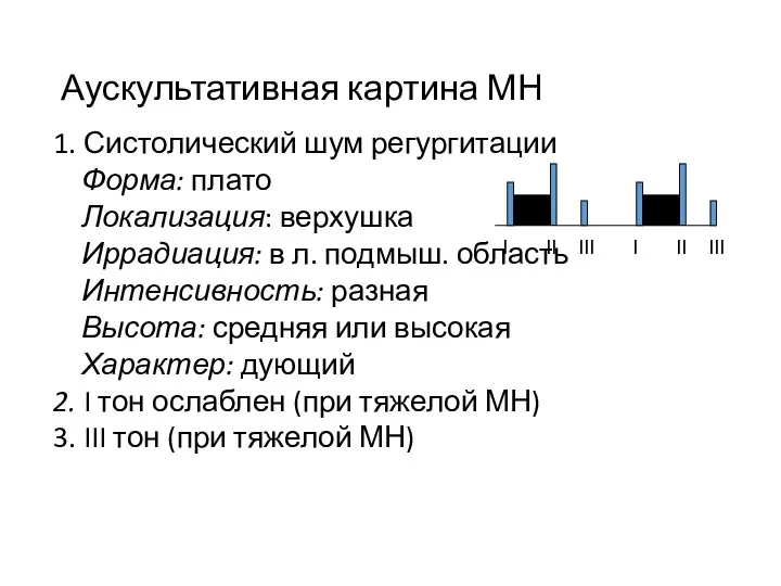 Аускультативная картина МН 1. Систолический шум регургитации Форма: плато Локализация: