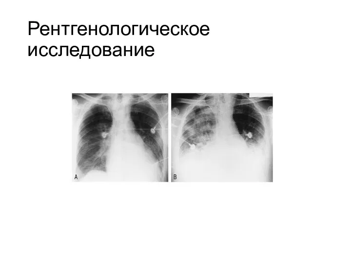 Рентгенологическое исследование