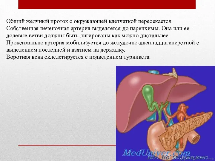 Общий желчный проток с окружающей клетчаткой пересекается. Собственная печеночная артерия