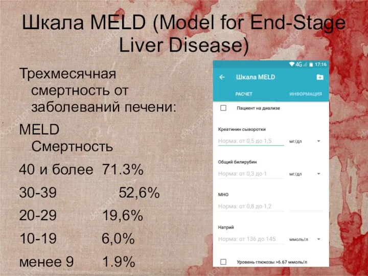 Шкала MELD (Model for End-Stage Liver Disease) Трехмесячная смертность от заболеваний печени: MELD