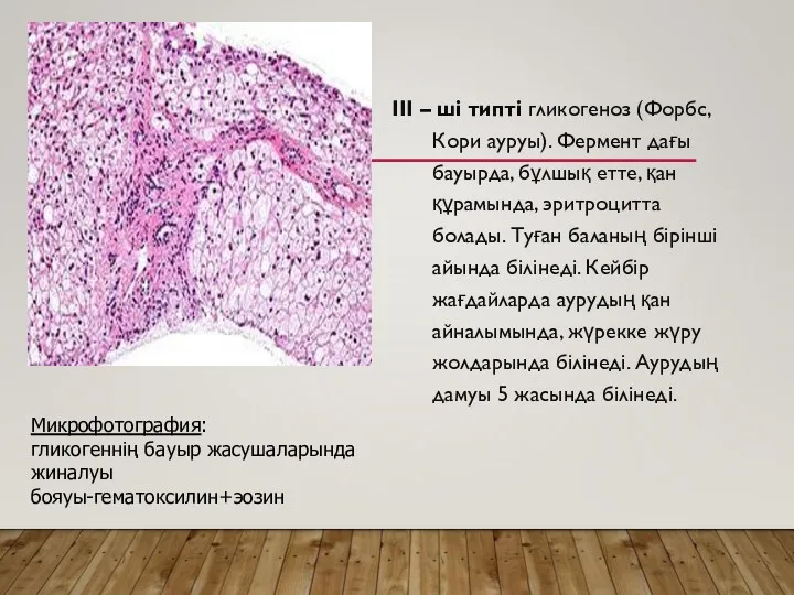 III – ші типті гликогеноз (Форбс,Кори ауруы). Фермент дағы бауырда,