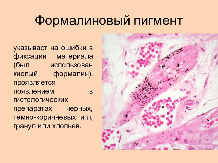 Формалиновый пигмент указывает на ошибки в фиксации материала (был использован