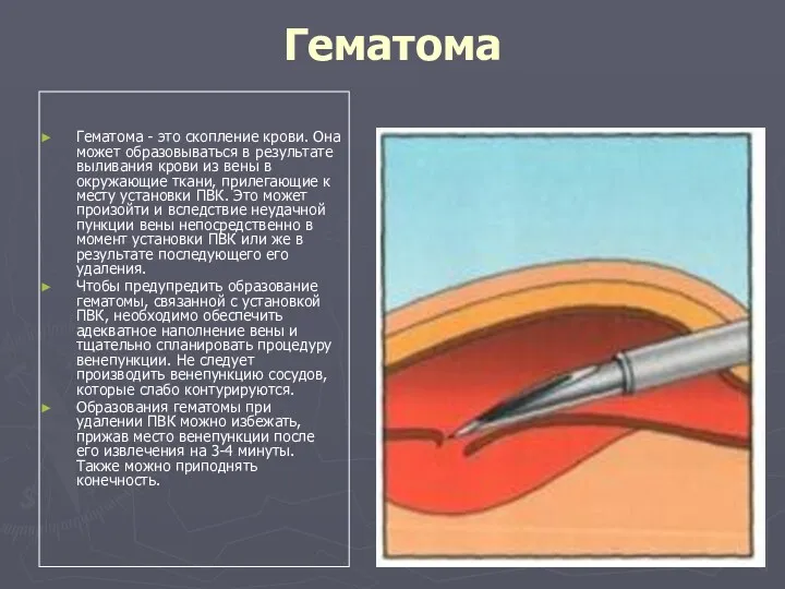 Гематома Гематома - это скопление крови. Она может образовываться в результате выливания крови