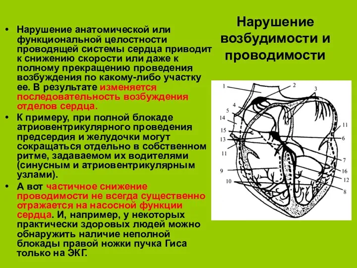 Нарушение возбудимости и проводимости Нарушение анатомической или функциональной целостности проводящей системы сердца приводит