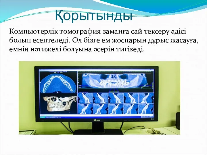 Қорытынды Компьютерлік томография заманға сай тексеру әдісі болып есептеледі. Ол бізге ем жоспарын