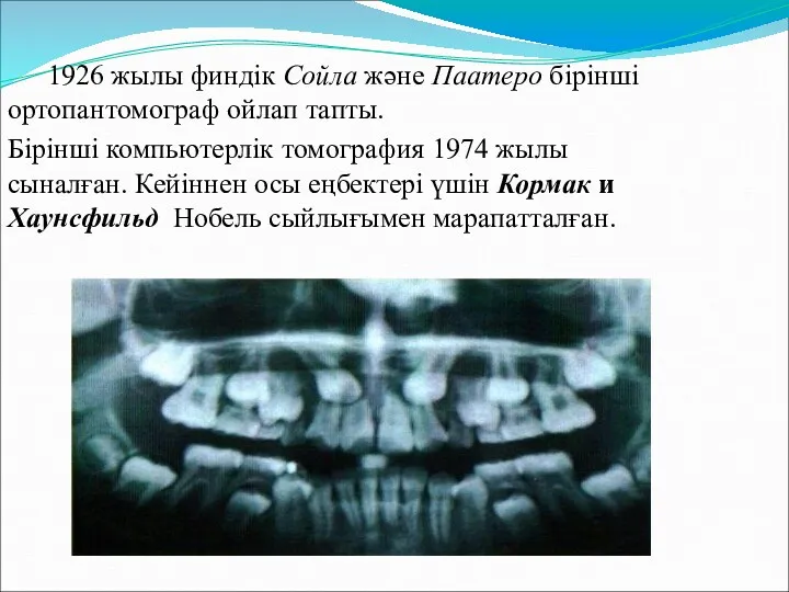 1926 жылы финдік Сойла және Паатеро бірінші ортопантомограф ойлап тапты. Бірінші компьютерлік томография