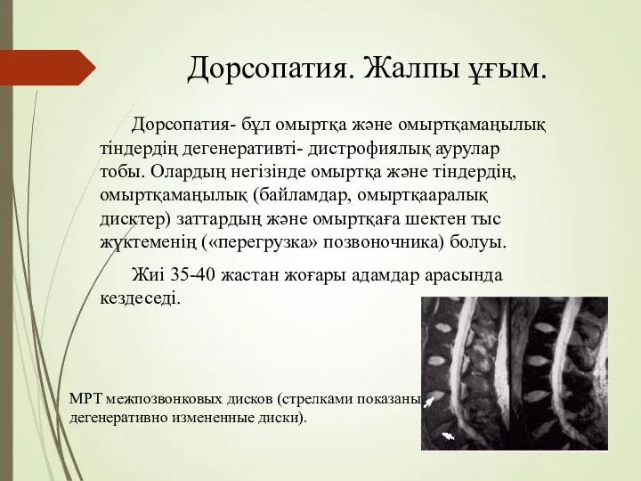 Дорсопатия. Жалпы ұғым. Дорсопатия- бұл омыртқа және омыртқамаңылық тіндердің дегенеративті-