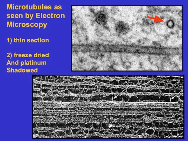 Microtubules as seen by Electron Microscopy 1) thin section 2) freeze dried And platinum Shadowed