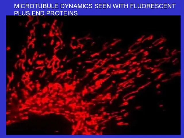 MICROTUBULE DYNAMICS SEEN WITH FLUORESCENT PLUS END PROTEINS