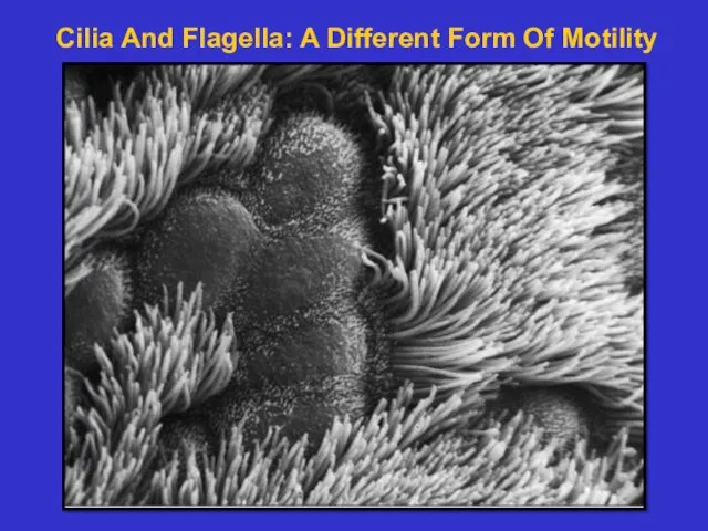 Cilia And Flagella: A Different Form Of Motility