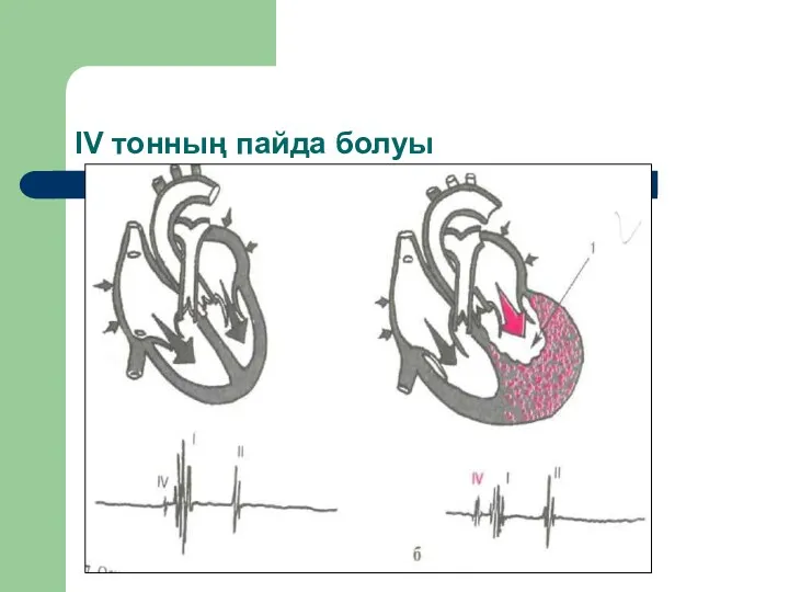 IV тонның пайда болуы