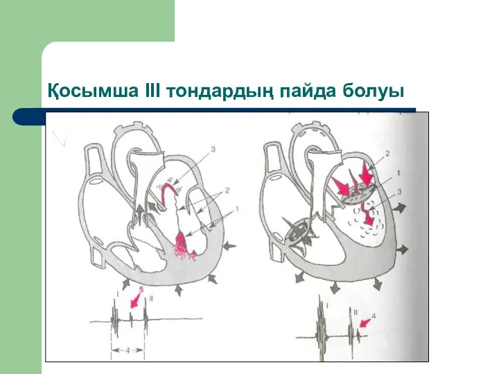 Қосымша ІІІ тондардың пайда болуы