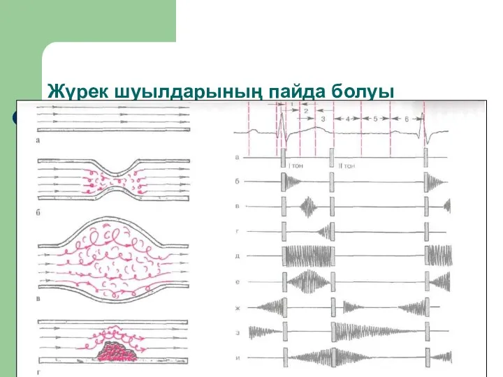 Жүрек шуылдарының пайда болуы