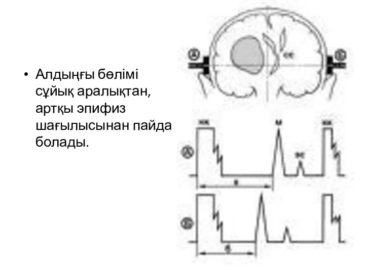 Алдыңғы бөлімі сұйық аралықтан,артқы эпифиз шағылысынан пайда болады.