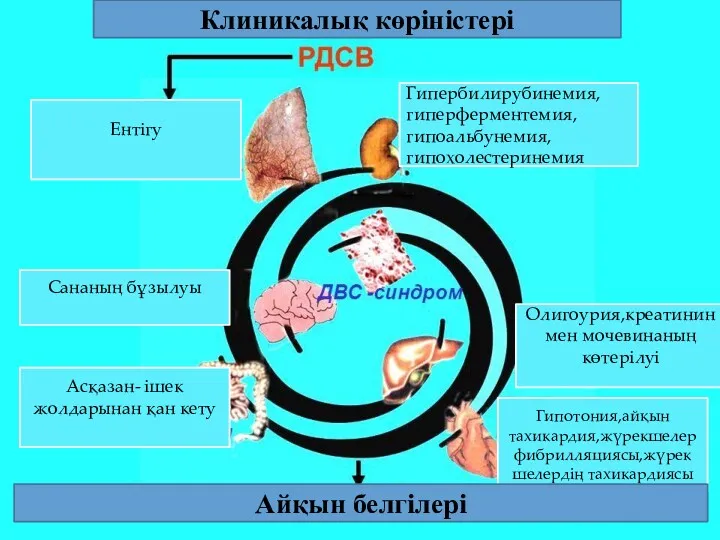 Клиникалық көріністері Ентігу Гипербилирубинемия,гиперферментемия,гипоальбунемия,гипохолестеринемия Сананың бұзылуы Гипотония,айқын тахикардия,жүрекшелер фибрилляциясы,жүрек шелердің