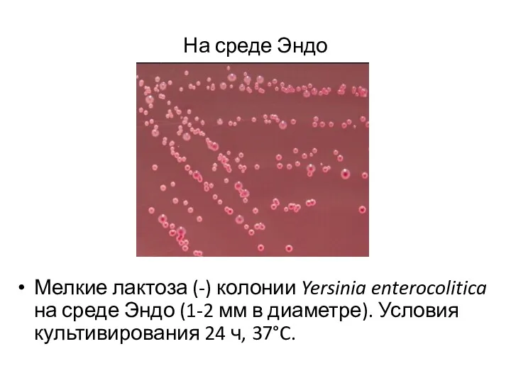 На среде Эндо Мелкие лактоза (-) колонии Yersinia enterocolitica на