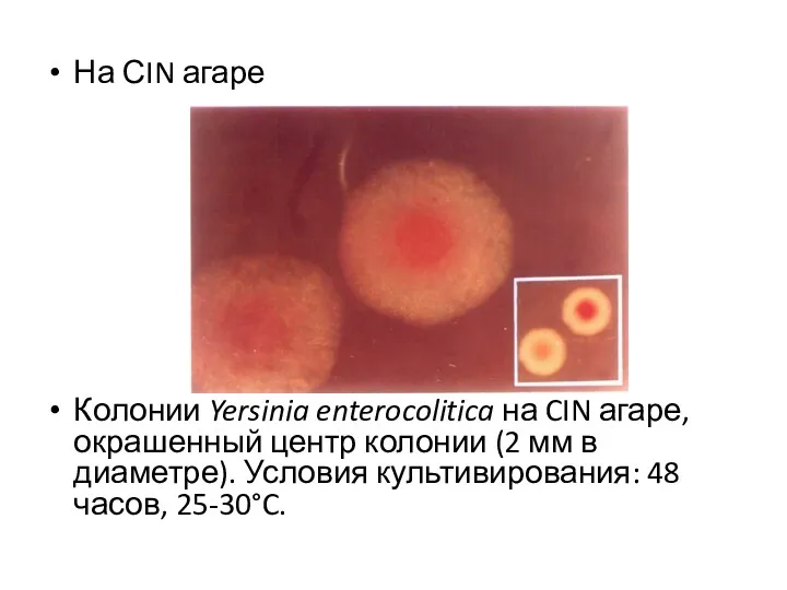 На СIN агаре Колонии Yersinia enterocolitica на CIN агаре, окрашенный центр колонии (2