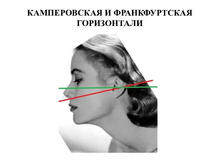 КАМПЕРОВСКАЯ И ФРАНКФУРТСКАЯ ГОРИЗОНТАЛИ