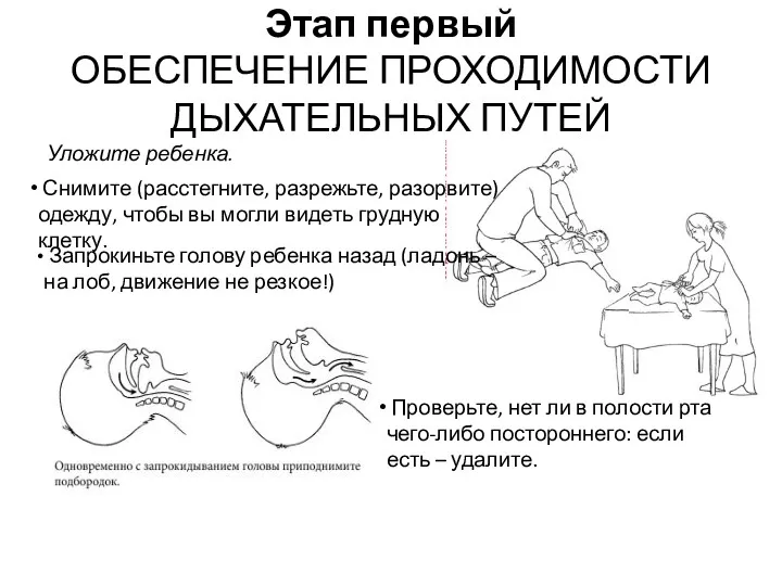 Этап первый ОБЕСПЕЧЕНИЕ ПРОХОДИМОСТИ ДЫХАТЕЛЬНЫХ ПУТЕЙ Уложите ребенка. Снимите (расстегните,