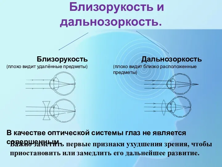 Близорукость и дальнозоркость. Близорукость (плохо видит удалённые предметы) Дальнозоркость (плохо видит близко расположенные