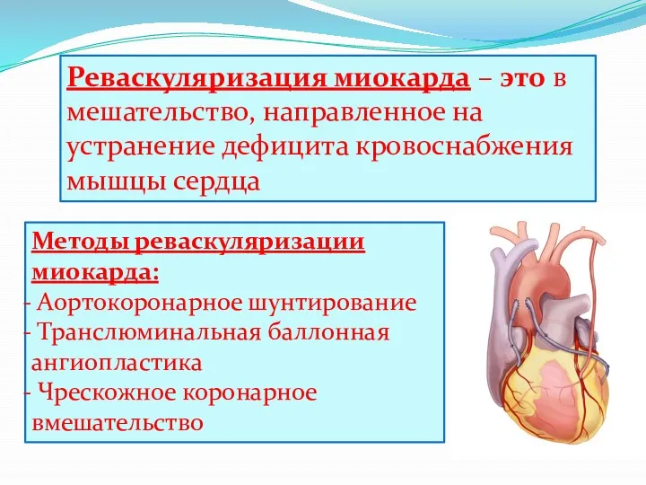 Реваскуляризация миокарда – это вмешательство, направленное на устранение дефицита кровоснабжения мышцы сердца Методы