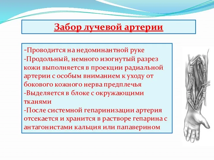 Забор лучевой артерии -Проводится на недоминантной руке -Продольный, немного изогнутый