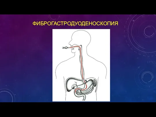 ФИБРОГАСТРОДУОДЕНОСКОПИЯ