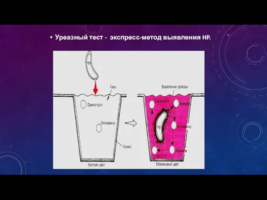 Уреазный тест - экспресс-метод выявления HP.