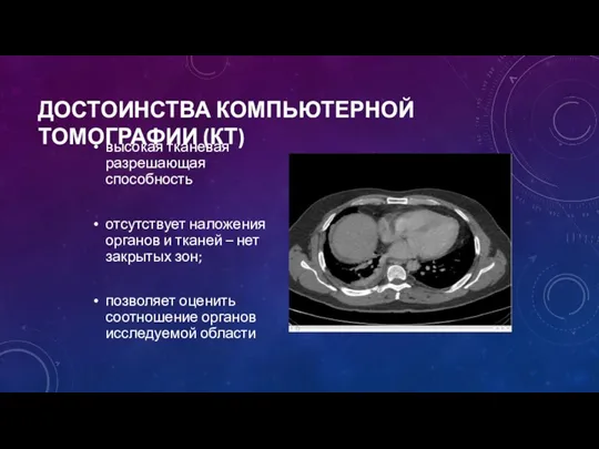 высокая тканевая разрешающая способность отсутствует наложения органов и тканей –