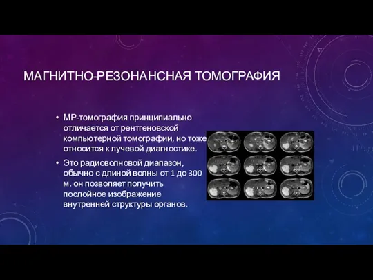 МАГНИТНО-РЕЗОНАНСНАЯ ТОМОГРАФИЯ МР-томография принципиально отличается от рентгеновской компьютерной томографии, но