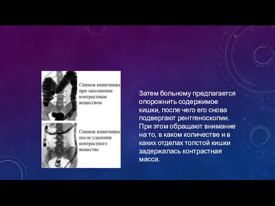 Затем больному предлагается опорожнить содержимое кишки, после чего его снова