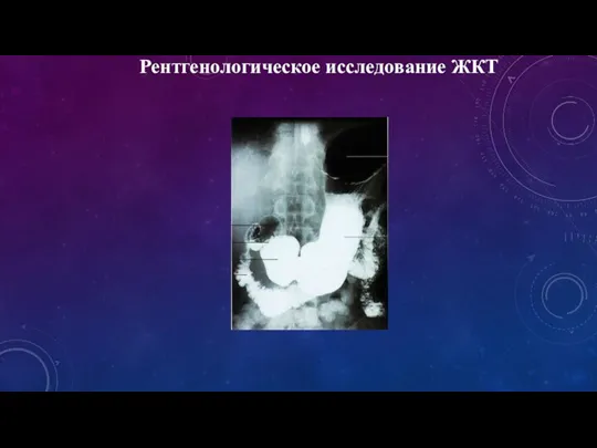 Рентгенологическое исследование ЖКТ