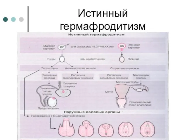 Истинный гермафродитизм