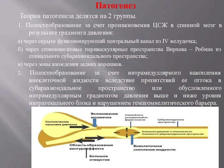 Патогенез Теории патогенеза делятся на 2 группы. 1. Полостеобразование за