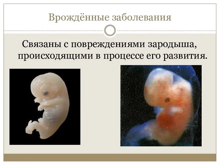 Врождённые заболевания Связаны с повреждениями зародыша, происходящими в процессе его развития.