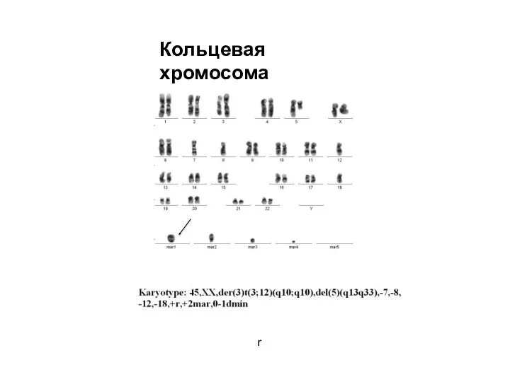 Кольцевая хромосома r
