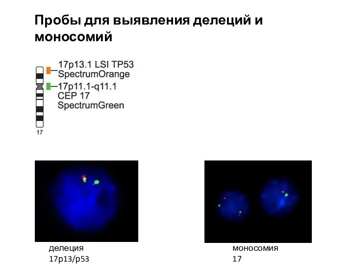 Пробы для выявления делеций и моносомий делеция 17р13/р53 моносомия 17