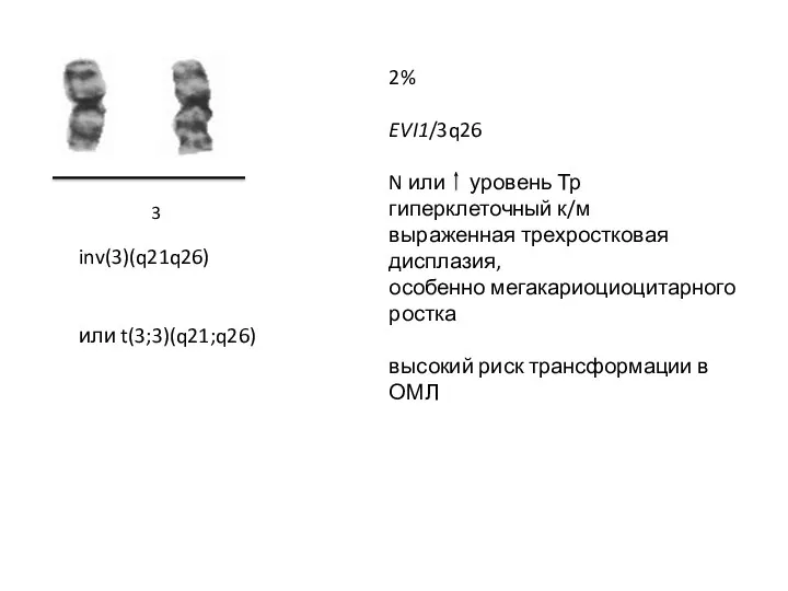 3 inv(3)(q21q26) или t(3;3)(q21;q26) 2% EVI1/3q26 N или уровень Тр гиперклеточный к/м выраженная