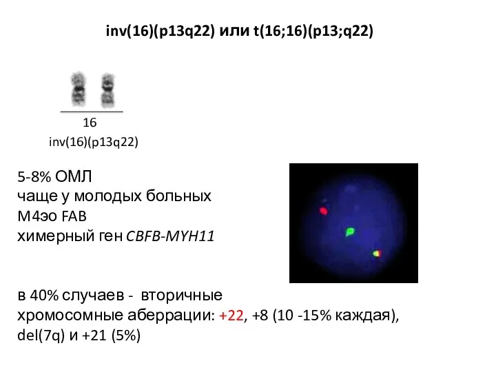 inv(16)(p13q22) 16 5-8% ОМЛ чаще у молодых больных M4эо FAB химерный ген CBFB-MYH11